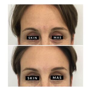 Anti Wrinkle