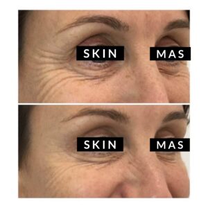 Anti Wrinkle