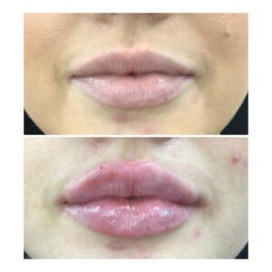 Juicy Lips Front