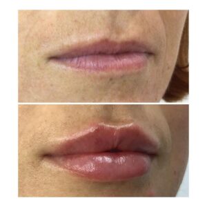 Juicy Lips